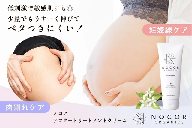 妊娠線の悩みにノコア アフタートリートメントクリーム【レビュー】